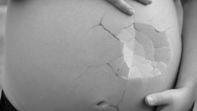 QuEm discurso paralelo na Assembleia Geral das Nações Unidas, os EUA e 18 outros países pediram o fim da linguagem ambígua em documentos sobre o aborto.anto mais pessoas souberem em que tipo de negócio a Planned Parenthood está metida, melhor | Pixabay