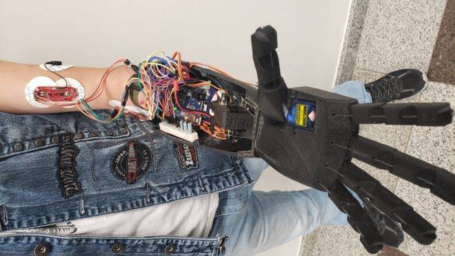 protese-eletronica-sebrae-startup-foto-adriano-oltramari