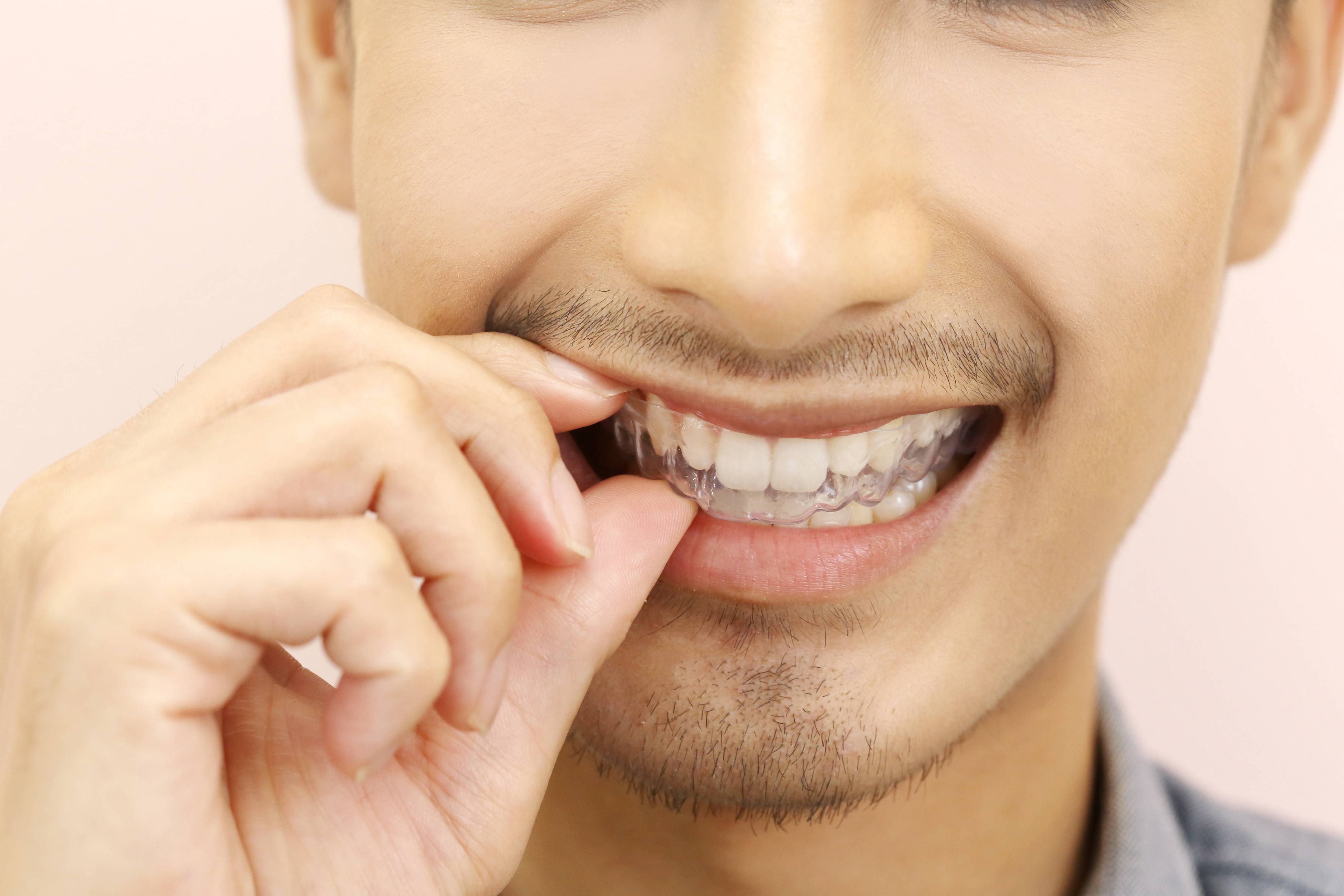 É de suma importância procurar um especialista para verificar qual é a melhor opção de clareamento para seu caso.