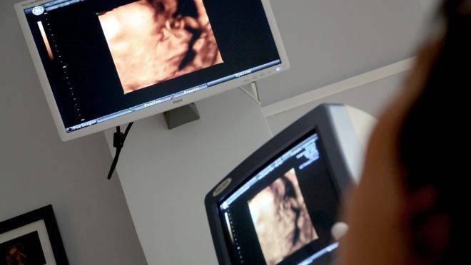Lei determina que médicos mostrem e descrevam exame de ultrassom, fazendo também as mães que querem abortar ouvirem o coração do feto batendo.