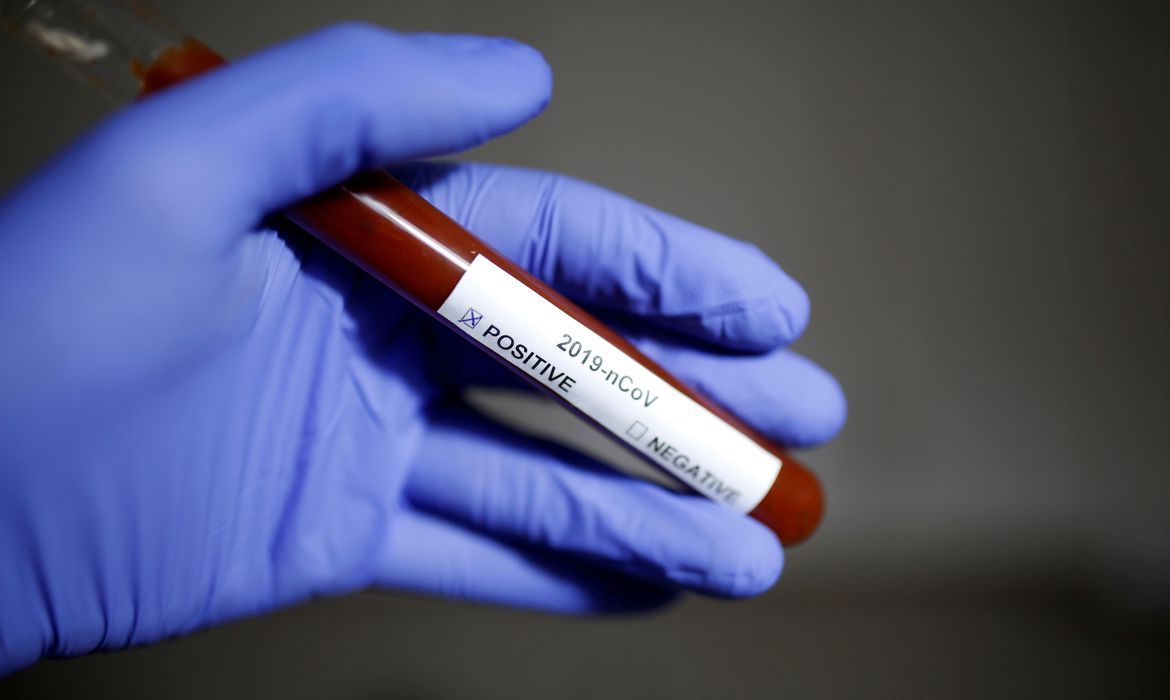 Aumento do coronavírus: Brasil está preparado para enfrentar aumento de casos?