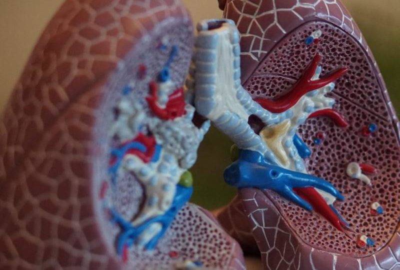 Desafio global mobiliza profissionais para criação de ventilador pulmonar de baixo custo Imagem: reprodução/MGH Fundation
