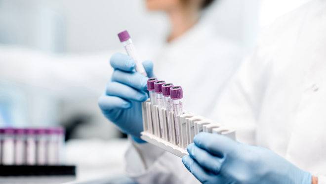 Laboratório unifica unidades e reforça a coleta domiciliar