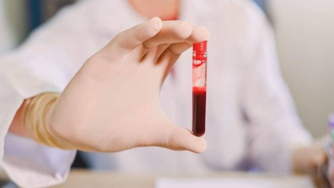 Tratamento com plasma de pessoas recuperadas da doença pode ser uma alternativa contra a Covid-19