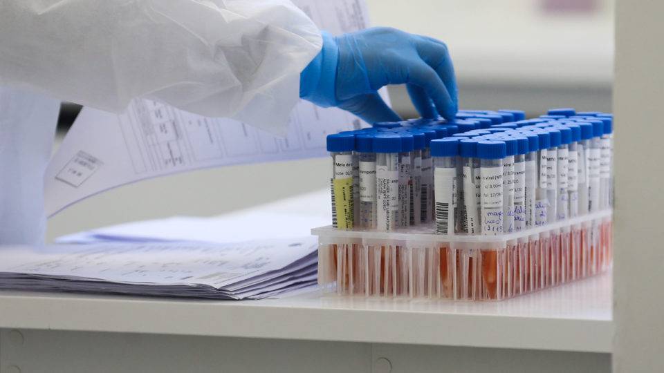 Ministério da Saúde: plano para testar casos leves da Covid-19 começará em breve testes para Covid-19