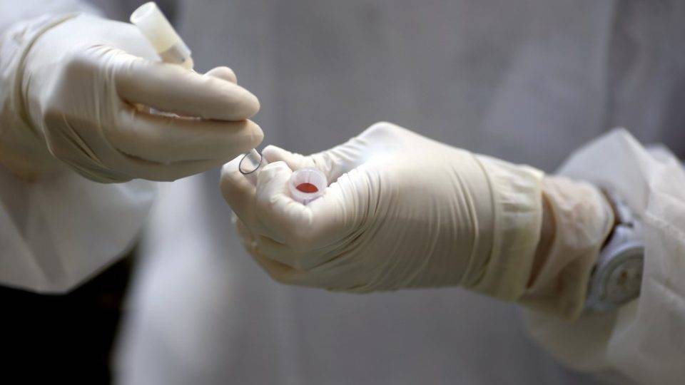 MPF investiga estudo com cloroquina depois da morte de 11 pacientes MPF investiga estudo com cloroquina depois da morte de 11 pacientes