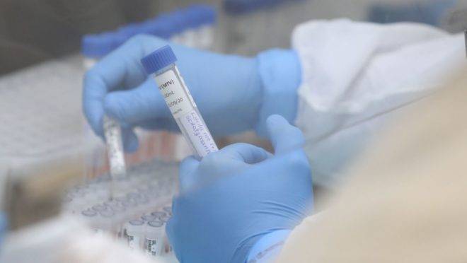 Testes de coronavírus estão sendo intensificados no Paraná.