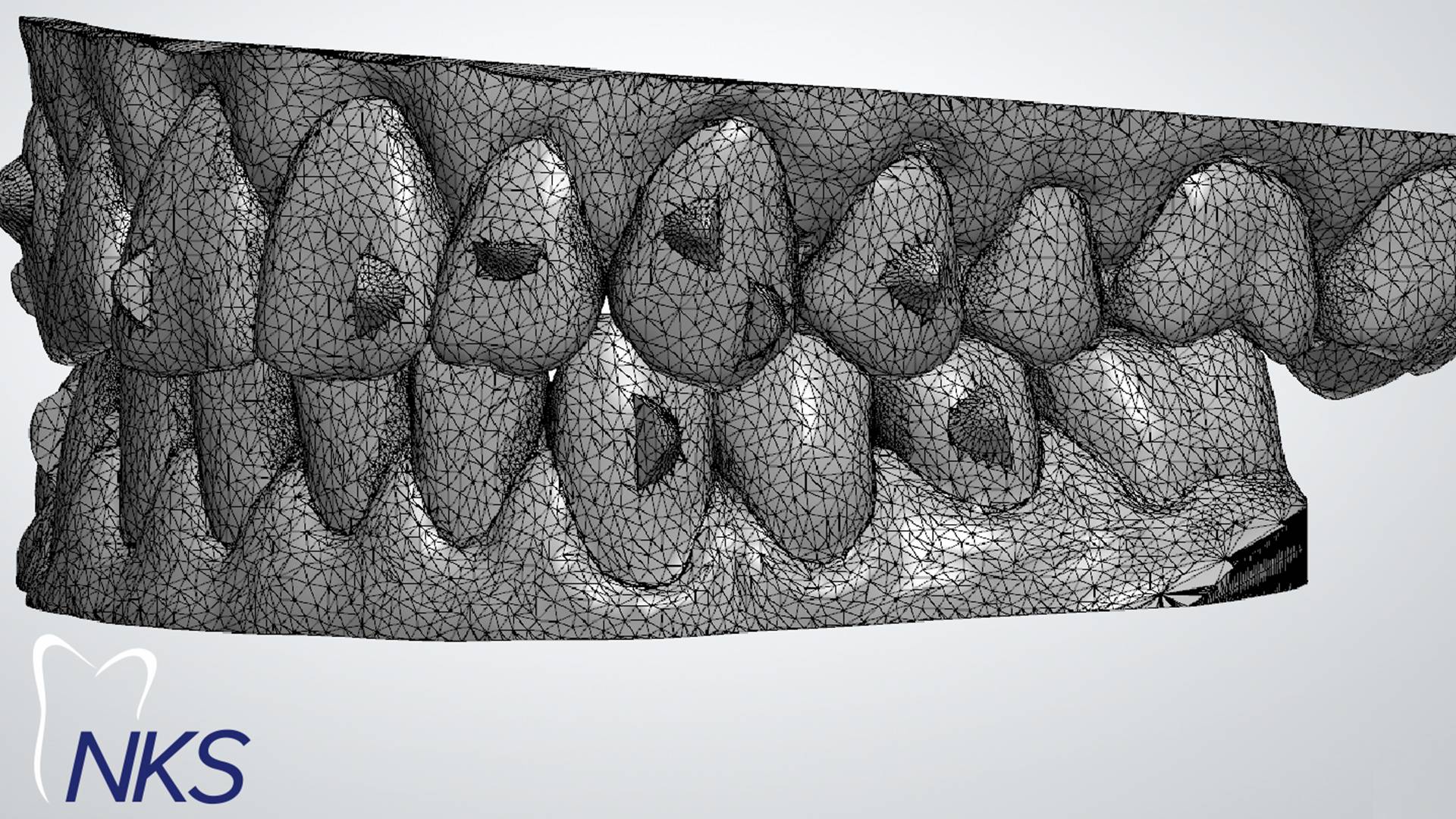 Tecnologia CAD/CAM garante tratamento mais efetivo na ortodontia