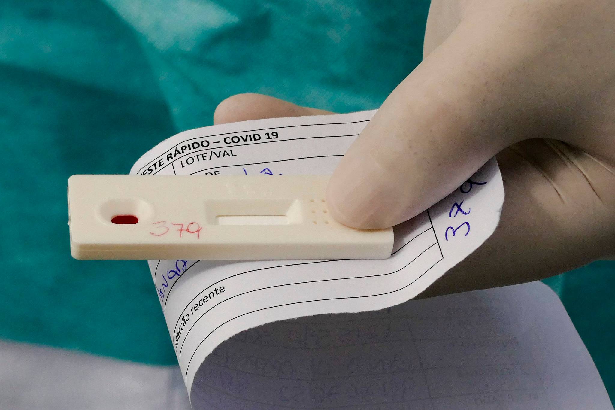 Conheça os tipos de testes para a Covid-19 que estão sendo feitos no Brasil