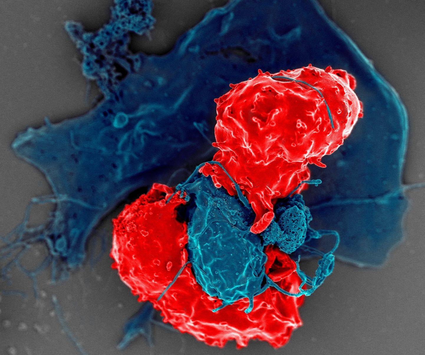 Células T atacam antígenos e protegem o organismo..