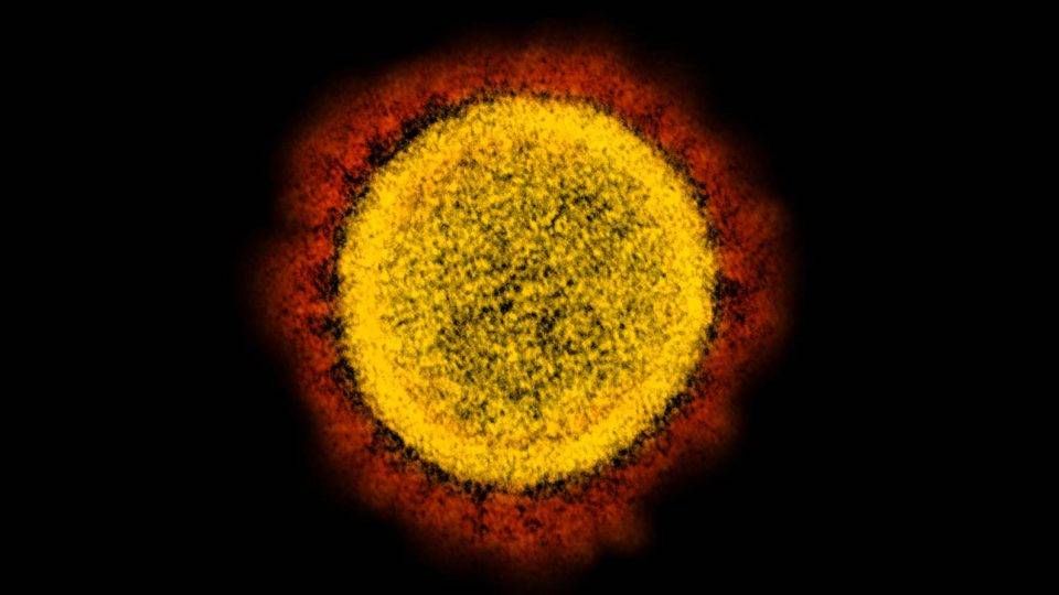 Ministério da Saúde atualizou os dados sobre a pandemia de Covid-19 no Brasil.