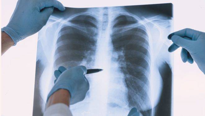 Principal trabalho de médicos e profissionais de saúde nas UTIs tem sido contra os sintomas para que a pessoa se recupere sozinha