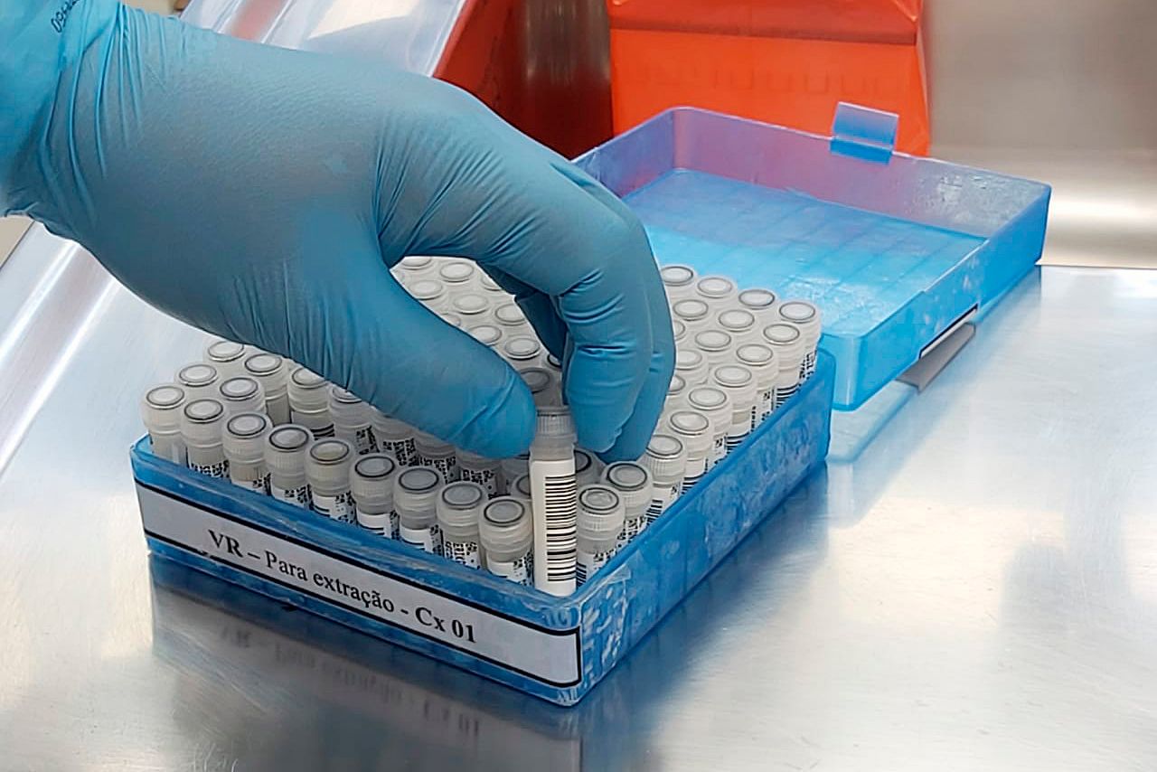 Exame de coronavírus. Foto: Sesa