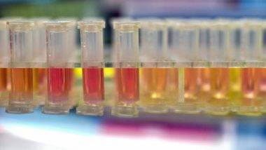 Testes de coronavírus (Covid-19). Foto: AFP