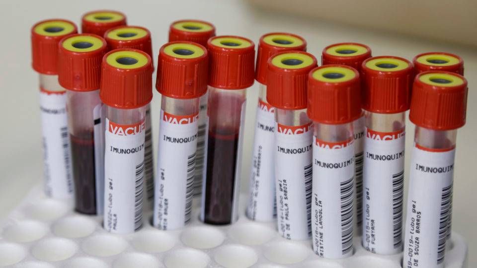 Planos de saúde são obrigados a cobrir teste sorológico para detectar Covid-19 Amostras para teste de coronavírus