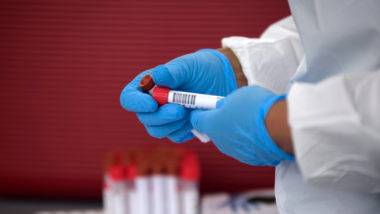 Teste para detectar coronavírus