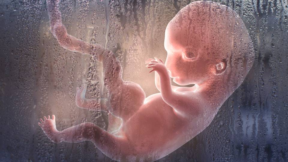 Países europeus usam o aborto para eliminar bebês com síndrome de Down Feto
