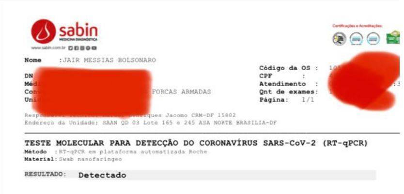 Exame de Bolsonaro que confirmou infecção pelo coronavírus