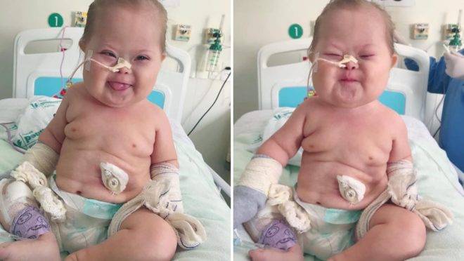 Conhecido na internet como "Super Chico" ele passou por sete cirurgias, tem cardiopatia, displasia pulmonar e contraiu Covid-19