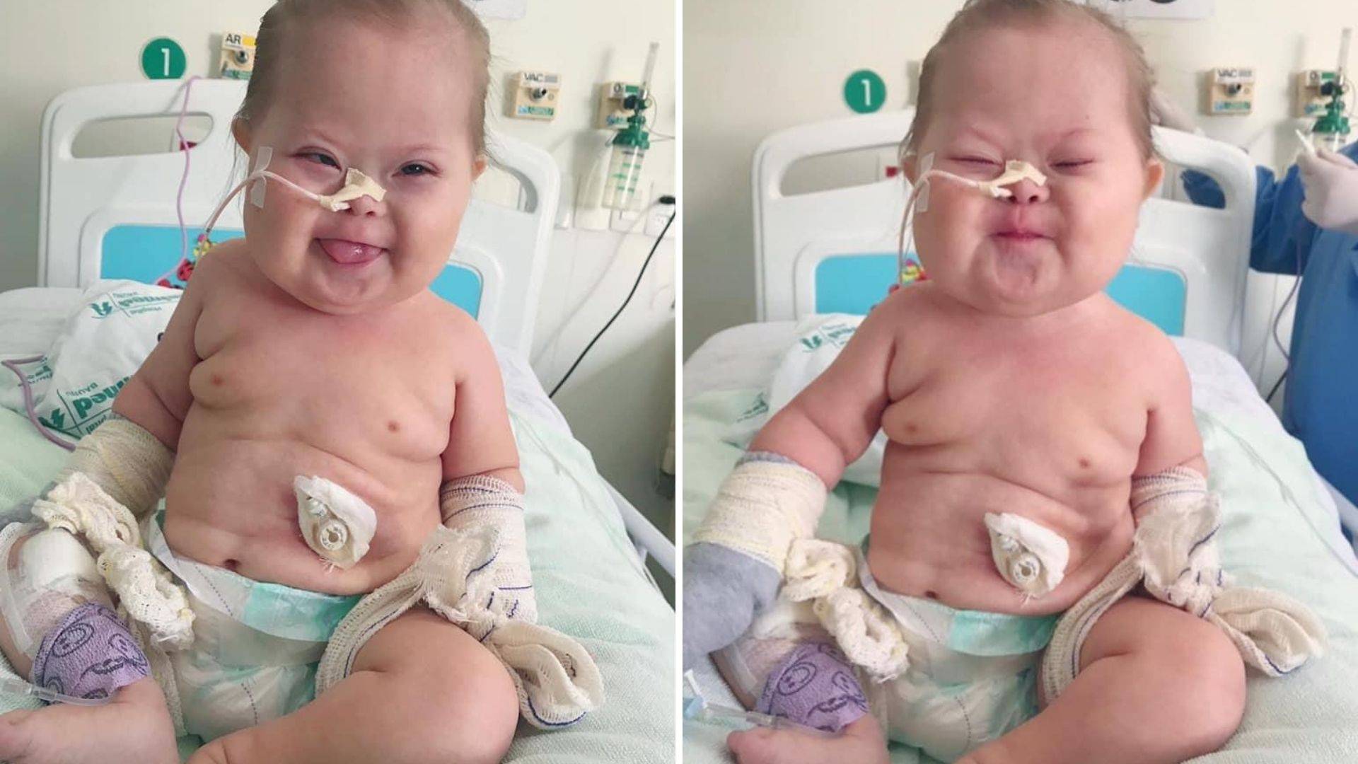 Conhecido na internet como &#8220;Super Chico&#8221; ele passou por sete cirurgias, tem cardiopatia, displasia pulmonar e contraiu Covid-19