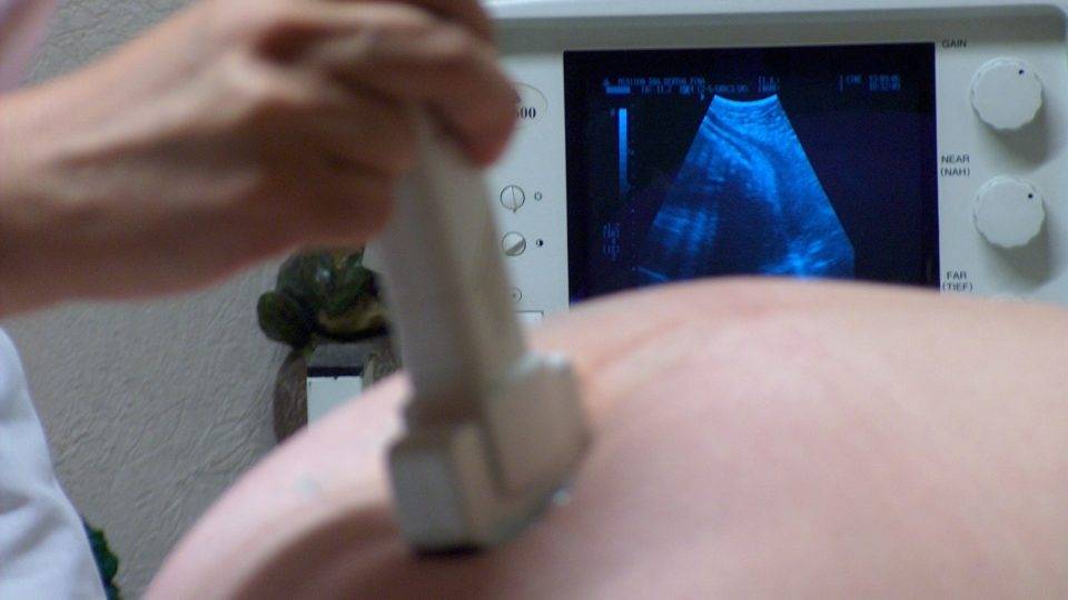 O aborto na França e o truque de linguagem Projeto na França tenta legalizar aborto até o nono mês de gestação em caso de “sofrimento psicossocial” da mãe.