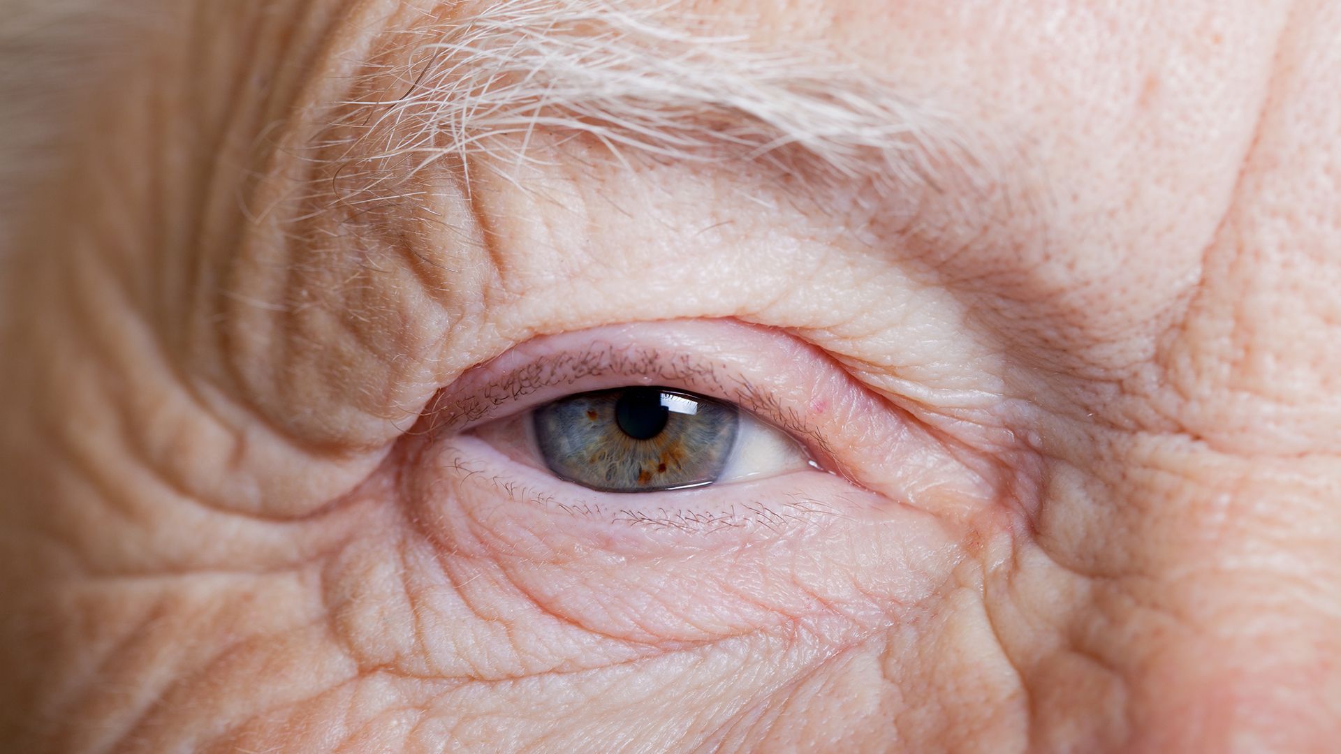 Saiba como cuidar bem da visão e como prevenir seus olhos na terceira idade