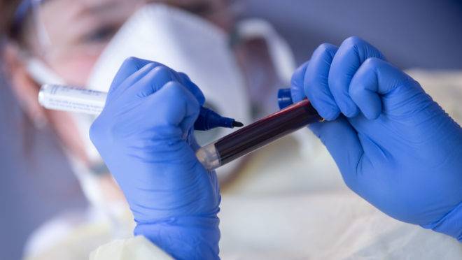 An employee of the Robert Koch Institute (RKI) for public health labels a blood sample for an antibody test on the novel coronavirus she has taken before from Christoph Spieles, mayor of the municipality of Kupferzell, southern Germany, following a press conference to present the study “Corona Monitoring Local” on May 19, 2020. – Kupferzell, that was one of the country’s novel coronavirus hotspots, is one four places where the Robert Koch Institute will study the spread of the virus. (Photo by Marijan Murat / POOL / AFP)