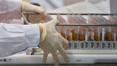 Amostras de sangue coletadas para exames de coronavírus