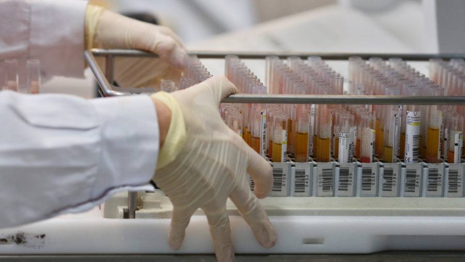 Amostras de sangue coletadas para exames de coronavírus
