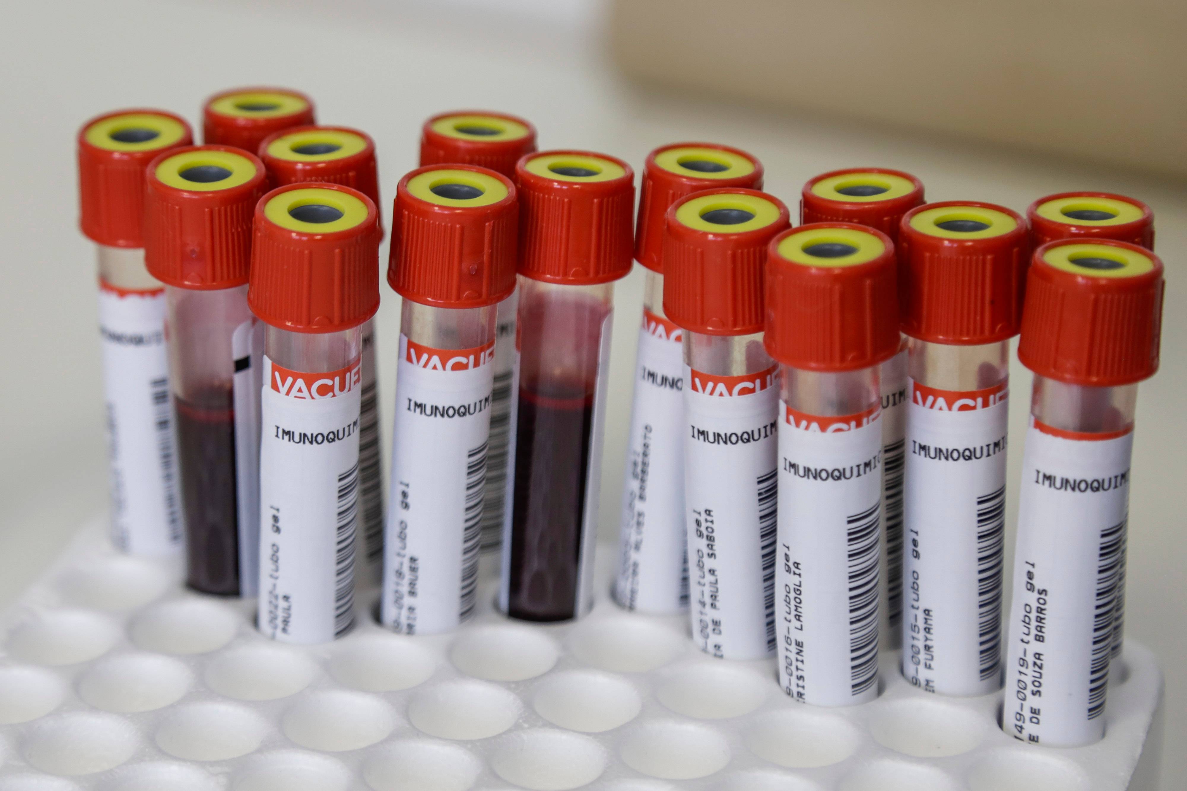 Testes de coronavírus