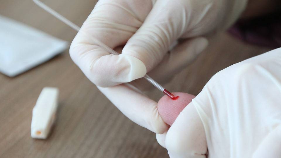 Curitiba registra 383 novos casos de infecção pelo novo coronavírus Exame rápido para detectar a Covid-19