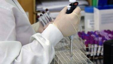 Teste de coronavírus