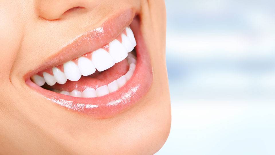 Resina ou porcelana: qual é a melhor faceta dentária para mim?