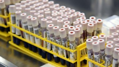 Pesquisadores identificam três mutações do Coronavírus em circulação no Paraná