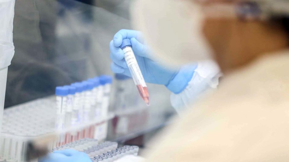 Covid-19: Paraná confirma mais 198 mortes e 6.446 novos casos de infecção Laboratório Central do Estado (Lacen)