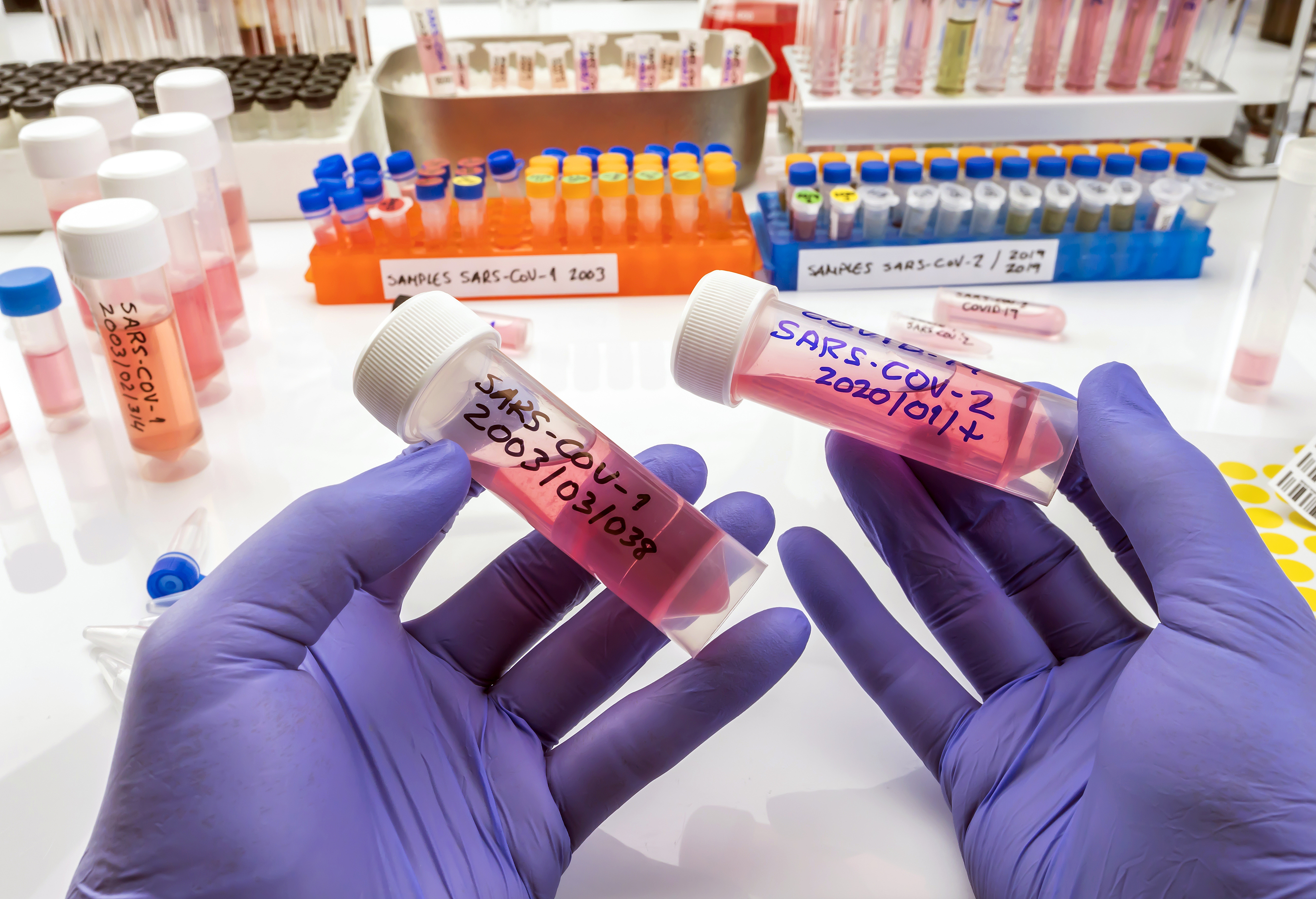 amostras de SARS-COV-1 preparadas em laboratório