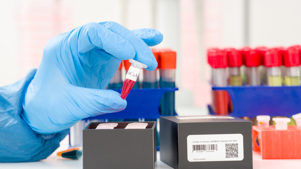 Origem do COVID: China impede perícia em laboratório por segurança nacional mão com luva de borracha azul segurando vários tubos de ensaio em cima de uma mesa