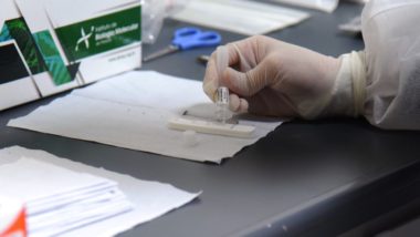 Paraná inicia testes de Covid-19 em passageiros que chegam pelo Afonso Pena Teste de Covid-19 sendo realizado no Afonso Pena.