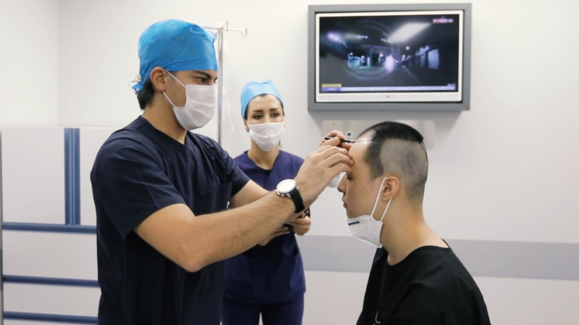 Mais de 25 milhões de homens brasileiros sofrem de algum grau de calvície