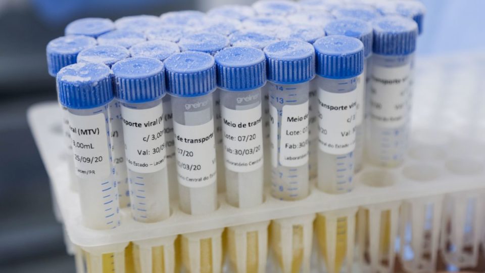 Paraná confirma mais 2,4 mil casos de coronavírus e 96 mortes por Covid-19 Centro de Especialidades Odontológicas se torna unidade exclusiva para atender profissionais da rede municipal de saúde com sintomas de covid-19. Curitiba, 24/04/2020. Foto: Pedro Ribas/SMCS