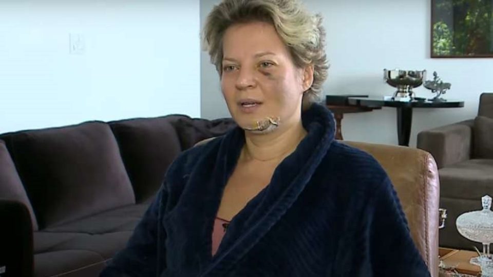 O que aconteceu a Joice Hasselmann Cinco dias depois do ocorrido, a deputada Joice Hasselmann aparece ferida e fala em atentado. Esse é um trabalho para Hercule Poirot ou Miss Marple?