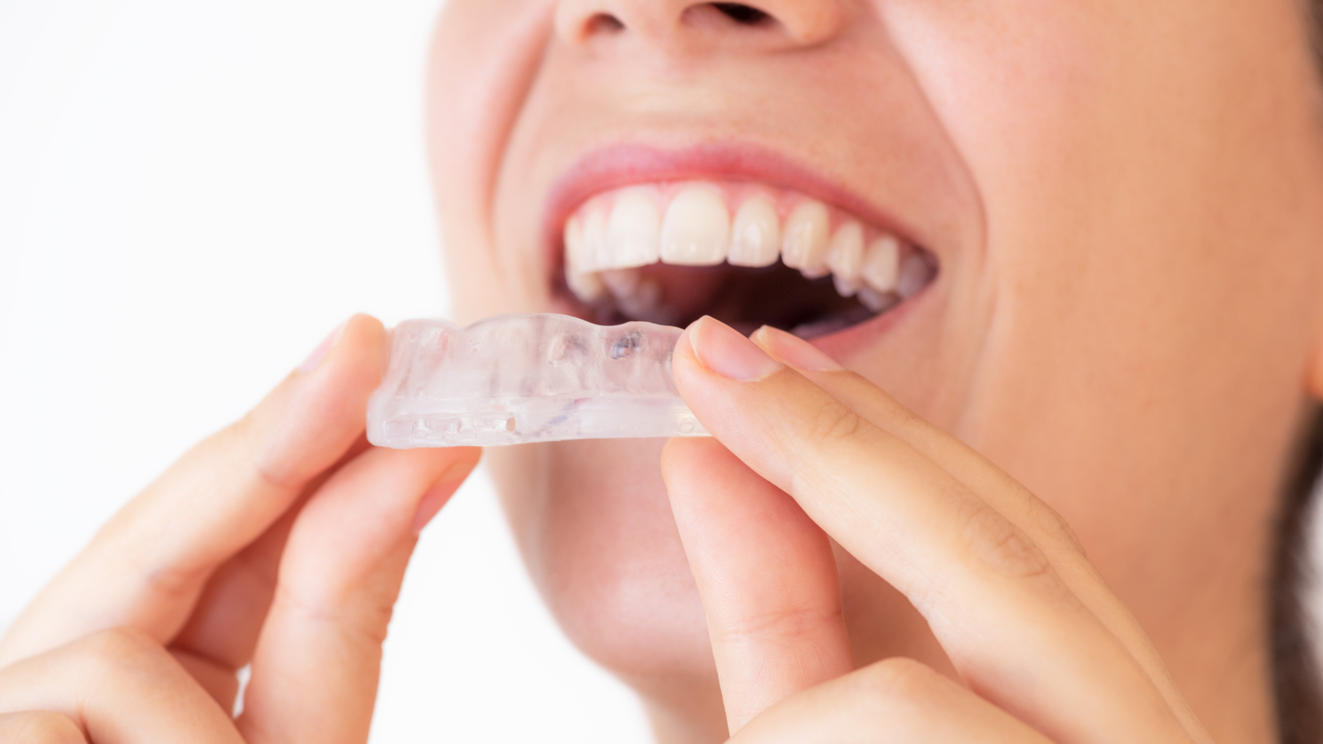 O bruxismo é o ato de apertar ou ranger os dentes involuntariamente, o que está bastante ligado à ansiedade, mas também prejudica a saúde bucal