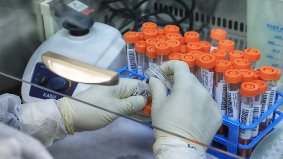 Brasil contabiliza 7.359 novos casos e mais 185 mortes por Covid-19 Testes de Covid-19