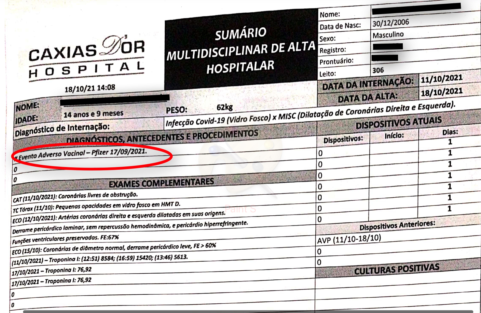 Excerto do sumário de alta hospitalar de F. Excerto do sumário de alta hospitalar de F.