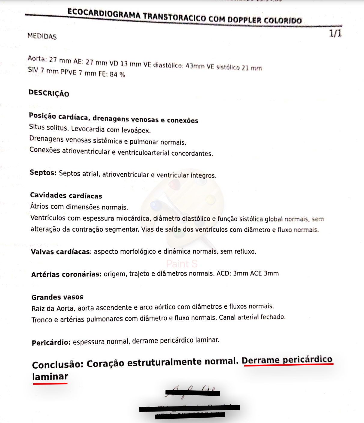 Ecocardiograma de F., indicando a pericardite Ecocardiograma de F., indicando a pericardite