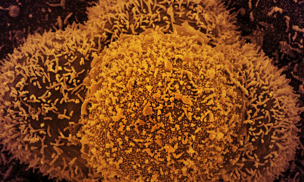 Incidência da Ômicron já é de 31,7%, diz estudo. 8 estados registraram casos da variante