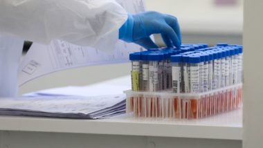 Sesa confirma três casos de coinfecção de Covid-19 e gripe H3N2 no Paraná Laboratório Central do Estado – LACEN – Recepção de amostras para teste do Coronavirus.
Curitiba, 01/04/2020 – Foto: Geraldo Bubniak/AEN