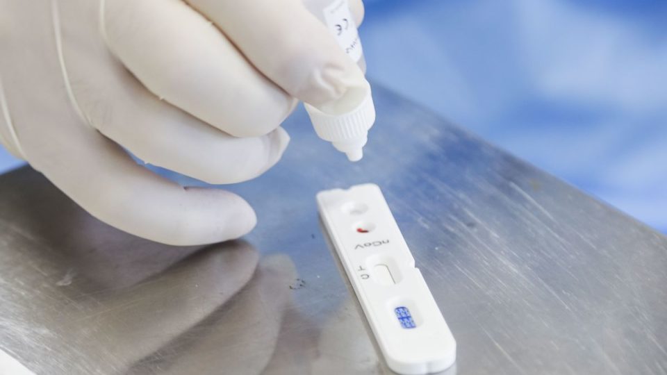 Anvisa indefere três pedidos de registro para autotestes de Covid-19 Centro de Especialidades Odontológicas se torna unidade exclusiva para atender profissionais da rede municipal de saúde com sintomas de covid-19. Na imagem teste rápido. Curitiba, 24/04/2020. Foto: Pedro Ribas/SMCS