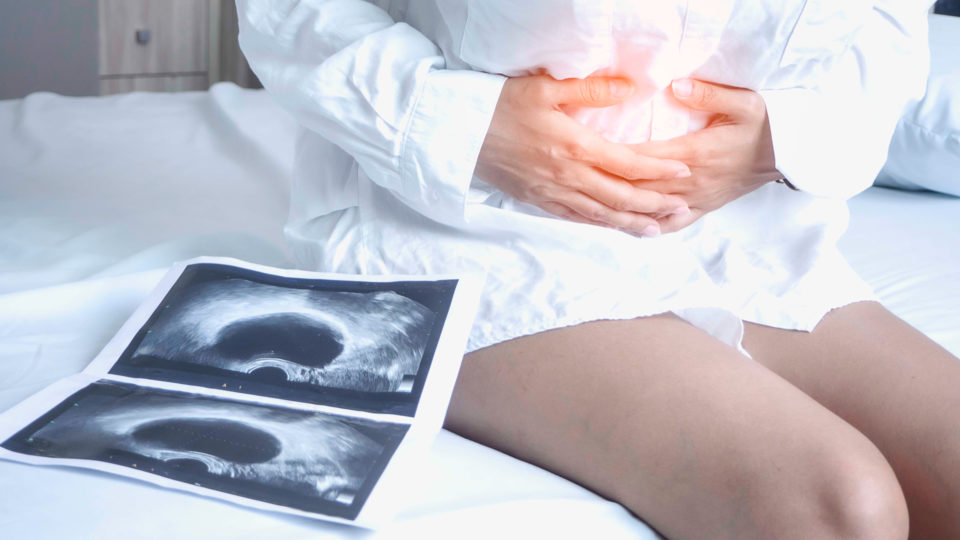 Endometriose: entenda o que é e como diagnosticar Doença de difícil diagnóstico, a endometriose afeta mulheres durante todo o período reprodutivo.