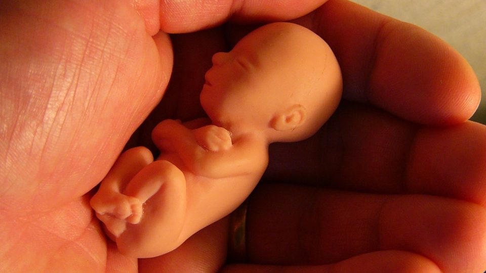 O “abortoduto” adiado e a batalha pela vida no Congresso Réplica em tamanho real de bebê com 12 semanas de gestação.